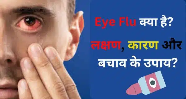 Eye-Flu-क्या-है-bantiblog.com